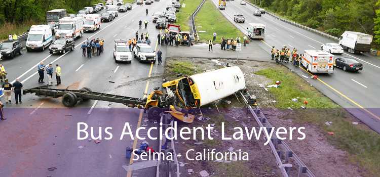 Bus Accident Lawyers Selma - California